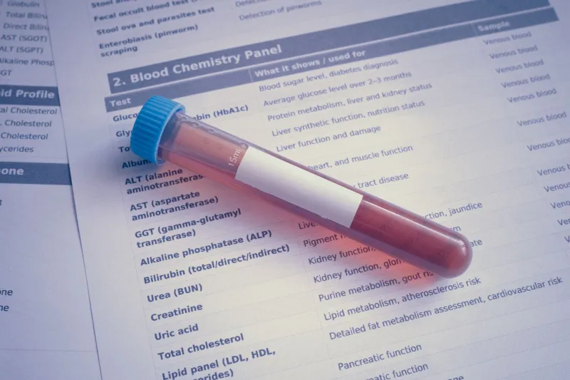 Two Systems, One Breakdown: How Thyroid Dysfunction Quietly Undermines Your Testosterone